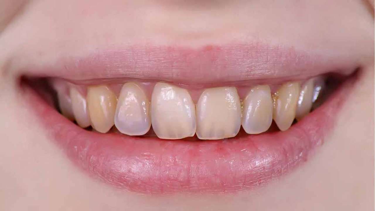 Tác hại của bột than tre