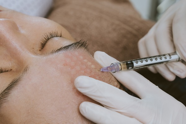 Cách hoạt động của mesotherapy